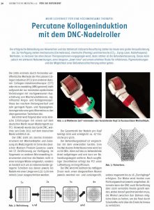 cutaris Zentrum - Beitrag Nadelroller